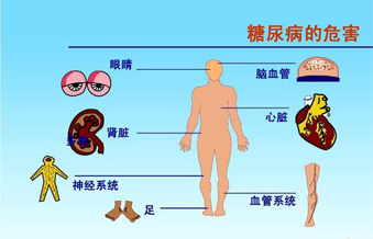 2型糖尿病对身体危害大吗？